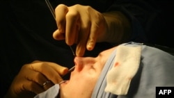 Пластическая операция коррекции формы носа. Такая же была сделана Юлии Кубаревой