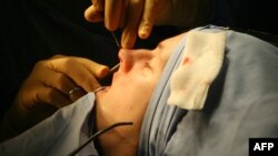 Тошкентдаги хусусий клиника врачининг айтишича, ўзбекистонлик аёллар кўпроқ юзларидаги ажинларини торттириш муолажаларини қилдирса-да, тананинг бошқа қисмларини “тўғрилаш” операциялари ҳам тез-тез ўтказиб турилади.