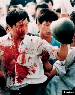 4 июня. Окровавленный демонстрант держит военную каску