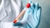 Firma AstraZeneca reia testele pentru vaccinul anti-Covid în Marea Britanie
