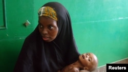 A woman holds a malnourished baby in the Somali capital, Mogadishu.