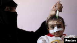 Жінка в лікарні столиці Ємену Санаа годує доньку, що страждає від недоїдання, за допомогою шприца, жовтень 2020 року. За даними ООН, через конфлікт 22 мільйони людей потребують гуманітарної допомоги
