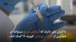 نتیجۀ آزمایش کرونا در چهل دقیقه