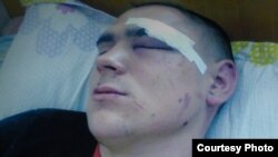 Вадим Маурер, брат подсудимого подростка, в больнице, куда он попал после пребывания в опорном пункте полиции. Фото предоставлено Натальей Маурер.