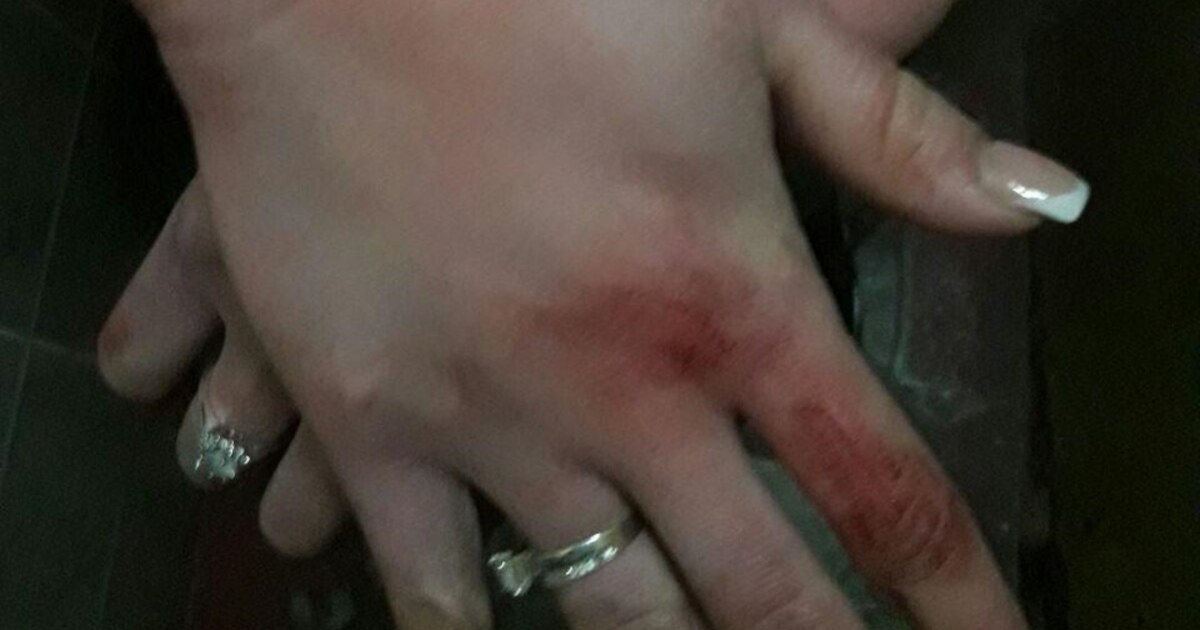 Yalangoch qizlar, quyonlar yoq