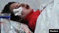 Журналистка Татьяна Чорновил на больничной койке после избиения. Киев, 25 декабря 2013 года.