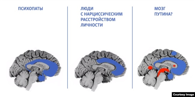 Иллюстрации к докладу "Внутри путинского мозга"