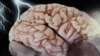 بازی‌های فکری مغز سالخوردگان را «بزرگتر» می‌کند