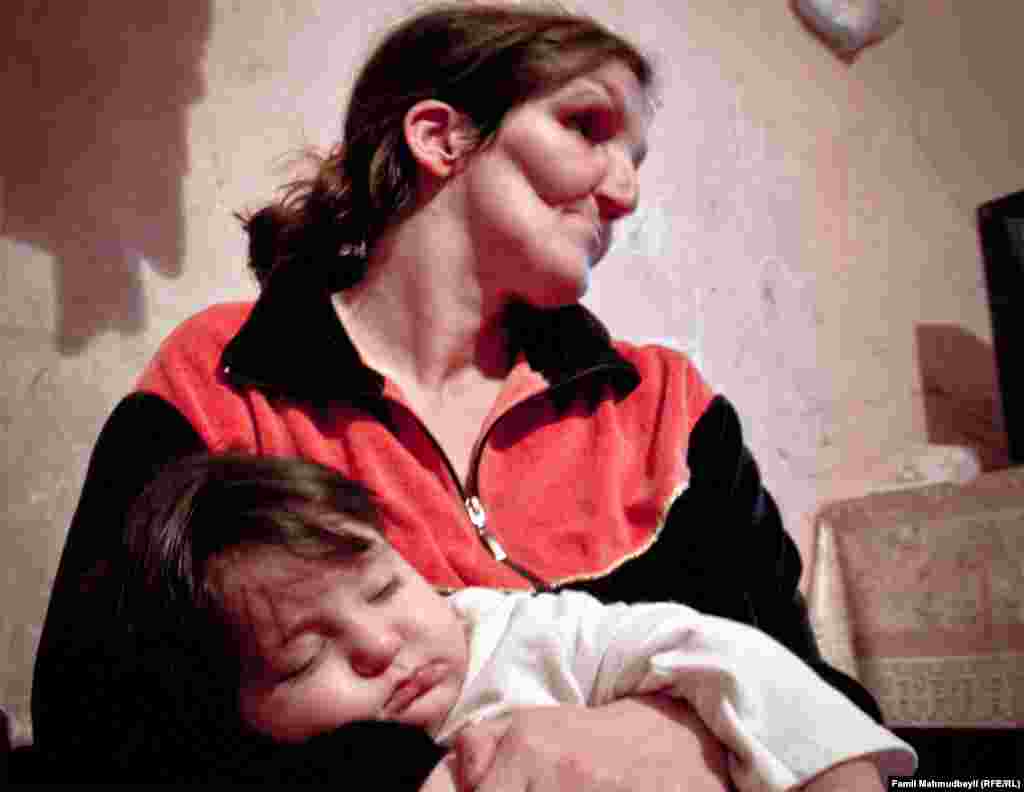 Вместе с воспоминаниями, Лейла получила пожизненный&nbsp;&laquo;подарок&raquo;:&nbsp;&laquo;Меня ударили прикладом автомата по правой стороне головы. Вся правая сторона головы и лица у меня из пластмассы. Правый глаз у меня вообще не видит. А левый видит только на 40%. Пластмасса должна меняться каждые 10 лет. Я ходила на обследование. Доктор говорит, что имплант давно должен был быть заменен. Уже началось гниение. Для замены пластмассового импланта с меня требуют 17 тысяч манат&raquo;.&nbsp;