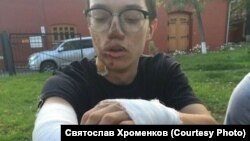 Обожженный в полицейской машине несовершеннолетний Максим Кокорин