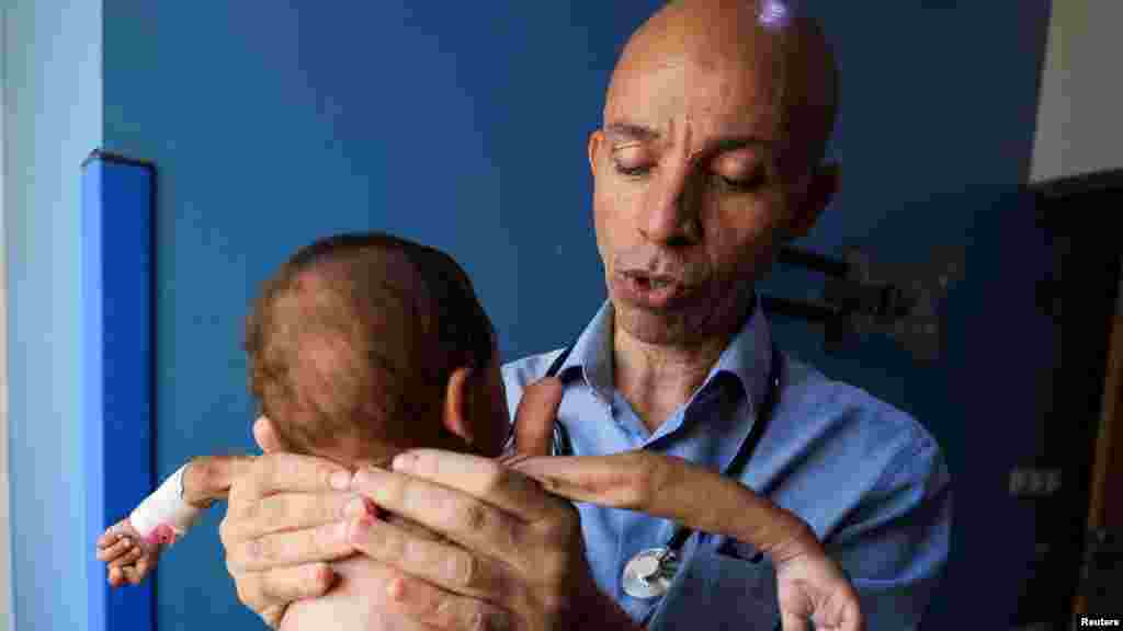 Doktor Ahmed Basal vizsgál egy alultáplált csecsemőt a gázavárosi Al-Rantisi Kórházban augusztus 7-én. Bár az élelmiszersegélyek izraeli blokádját július végén feloldották, még mindig nagyon kevés élelmiszersegély jut el az enklávéba