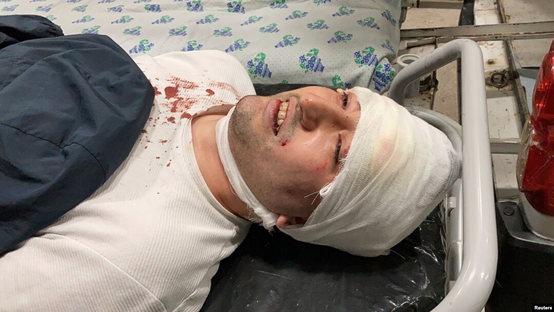 Miraziz Bazarov is shown upon his arrival at a hospital after he was beaten by a group of unidentified men in Tashkent on March 29, 2021.