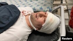 Miraziz Bazarov is shown upon his arrival at a hospital after he was beaten by a group of unidentified men in Tashkent on March 29, 2021.