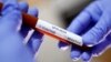 ثبت نخستین مورد ابتلا به ویروس کرونا در عربستان؛ فرد مبتلا به ایران رفته بود