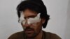 A photograph of Abdul Baqi taken after he was blinded by his father and brothers caused outrage in Pakistan after it was circulated on Facebook along with details of his horrific ordeal.