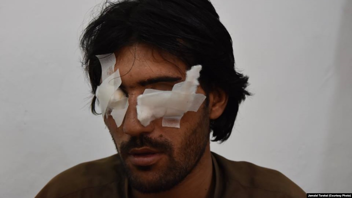 Pakistani Man Is Blinded By His Father Brothers For Wanting A