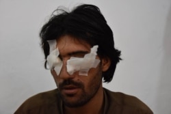 A photograph of Abdul Baqi taken after he was blinded by his father and brothers caused outrage in Pakistan after it was circulated on Facebook along with details of his horrific ordeal.