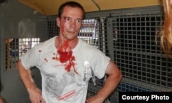 Ильдар Дадин был избит в "автозаке" после задержания, август 2014 года