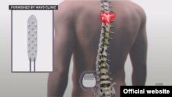 Un implant spinal