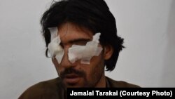 A photograph of Abdul Baqi taken after he was blinded by his father and brothers caused outrage in Pakistan after it was circulated on Facebook along with details of his horrific ordeal.