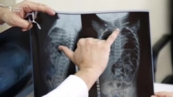 Кӯдаки 11-моҳа, ки аз баданаш 16 сӯзан пайдо шуд, шифо ёфтааст