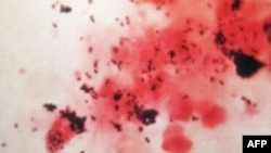 Холеранын козгогучтарынын микроскоптон көрүнүшү. Иллюстрациялык сүрөт.