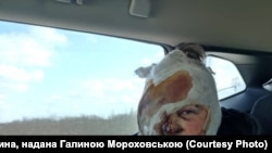 Галина Мороховська у такому вигляді після поранення 17 березня 2022 року покидала Маріуполь