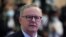 Prime Minister Anthony Albanese warned anyone considering acting against Australia's national security. (file photo)