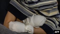 Раніше стало відомо, що Південна Корея вирішила відкликати частину співробітників свого посольства в Києві через розголошення інформації про передачу Сеулу двох північнокорейських військовополонених (на фото: полонений із КНДР, 2025 рік)