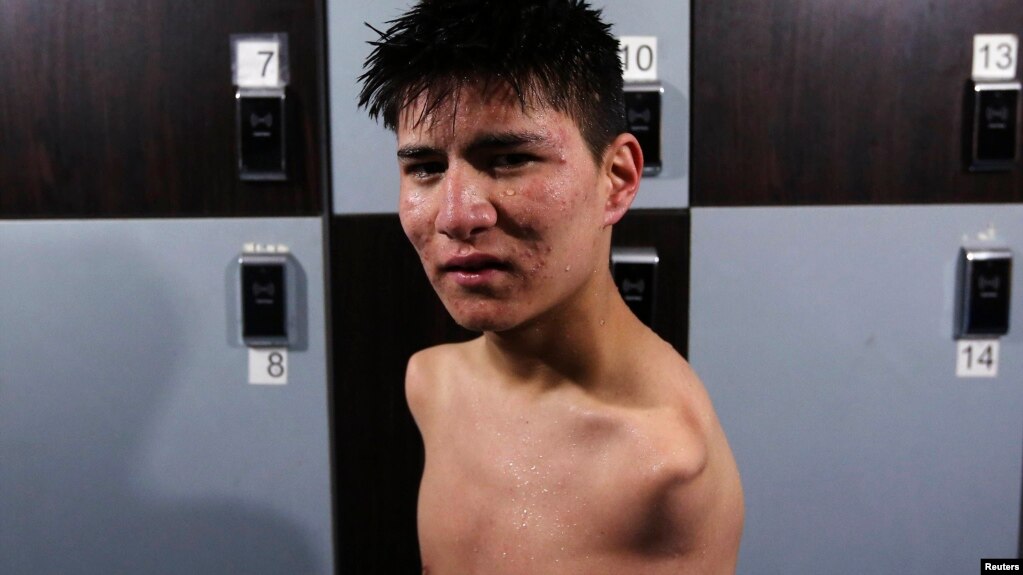 عباس کریمی آبباز افغان