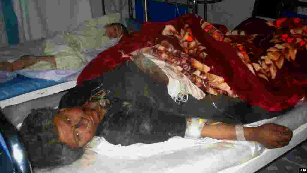 An injured woman receives treatment in a hospital in Farah Province.