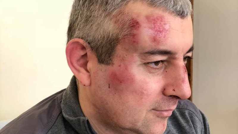 «Ударили по голове, стали жестоко избивать»: в Дагестане напали на главу местного «Мемориала»
