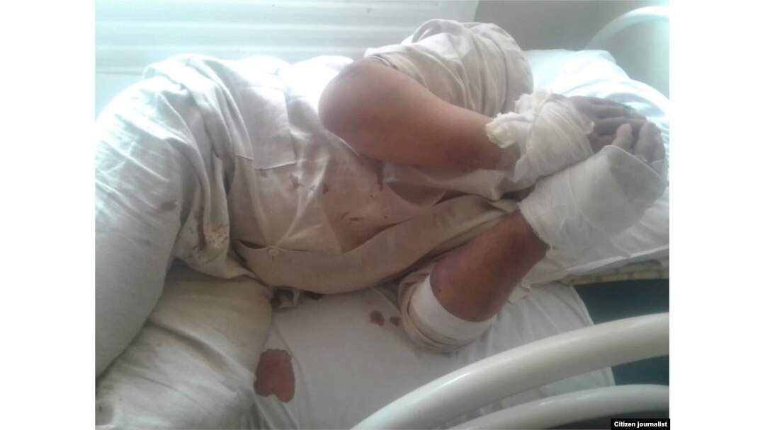 Шифохонада қолаётган муҳожирлар ёрдамга муҳтож