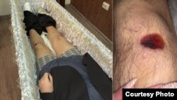 Снимки, сделанные семьей перед похоронами