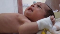 Afghan Baby Loses Legs In Attack That Also Killed Her Family