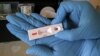 Un test rapid de coronavirus, cu rezultat negativ, 8 aprilie 2020