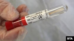 PCR тестовете изследват секрет, който медицинските специалисти взимат от гърлото на човека