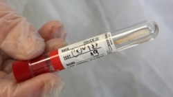 Зразок ПЛР-тесту на коронавірус