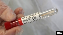 Covid–19-PCR-teszt