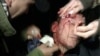 Lutsenko Hurt In Clash With Kyiv Police
