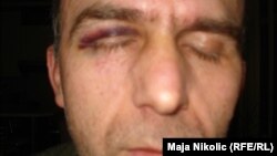Aleksandar Ninković nakon zlostavljanja u policiji