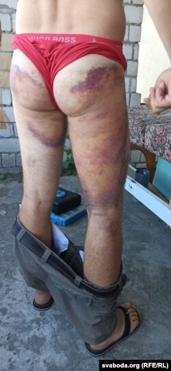 Дзьмітры Лукомскі быў зьбіты ў Цэнтральным РАУС Гомля
