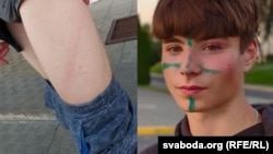 Mikita Sidarovich says he was beaten by police, who marked his face with green paint.
