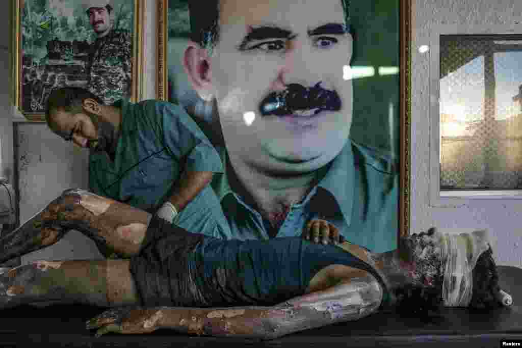 First Prize Singles in the General News category was won by freelance Brazilian photographer Mauricio Lima for his picture of an Islamic State militant being treated in a Kurdish hospital, on the outskirts of Hasaka, Syria. (August 1, 2015) 