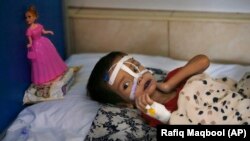 آرشیف، کودک مبتلا به سوءتغذی در افغانستان