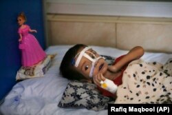 یک کودک بیمار سوء تغذیه در افغانستان