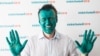 Алексей Навальный после нападения в Барнауле