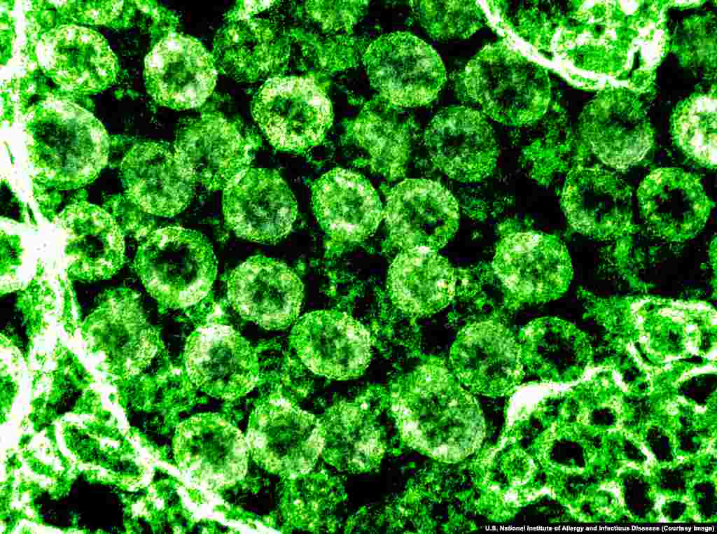 O imagine obținută la microscopul electronic a unui ciorchine de virioni SARS-CoV-2 Virionii coronavirusului se folosesc de acești țepi pentru a se prinde de unii receptori ai celulei&nbsp; umane, în special din plămâni, și astfel virusul poate intra în interiorul celulei.. &nbsp;