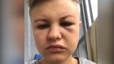 LGBT Assault Victim Waiting For Justice In Yekaterinburg