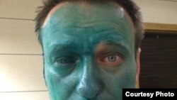 Алексей Навальный после нападения.
